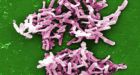 C. difficile kills 16 in Niagara Region