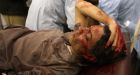 Pakistan bomb blasts kill 115
