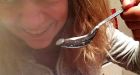 Girl had three-inch leech up her nose for a MONTH