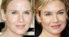 Renee Zellweger's face is unrecognisable